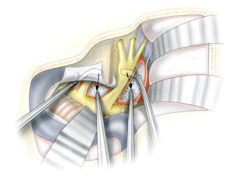 Lateral Approaches To Clivus Skull Base Surgery Atlas