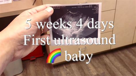 First Ultrasound At 5 Weeks 4 Days Expecting After Miscarriage Life