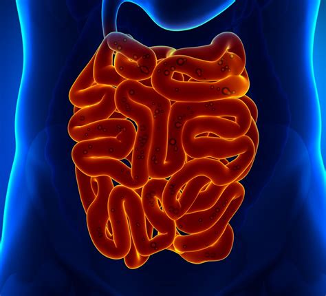 Small Intestine Infection Symptoms