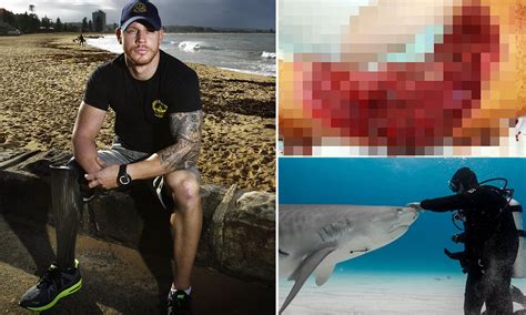 Graphic Shark Attack Photos