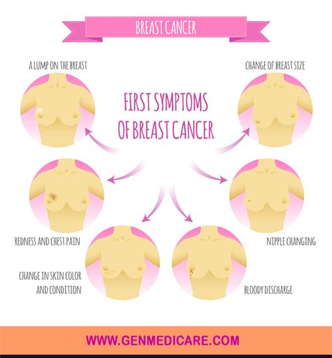 Oftentimes, breast cancer is discovered when someone notices a lump in their breast. What is breast cancer? Know Breast Cancer Treatment, Signs ...