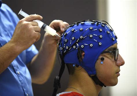 With Brain Implants The ‘futures Gonna Be Weird