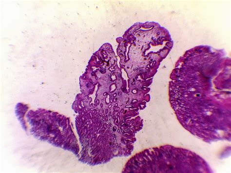 Gastrointestinal And Liver Histology Pathology Atlas Stomach