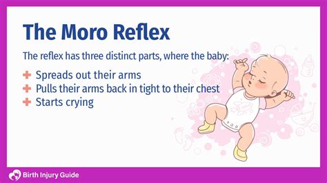 Are Birth Asphyxia And Moro Reflex Related Birth Injury Guide