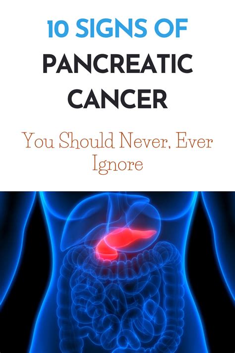 10 Signs Of Pancreatic Cancer You Should Never Ever Ignore