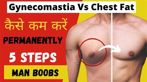 Gynecomastia How To Get Rid Of Man Boobs Chest Fat Puffy