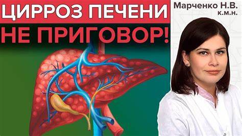 Цирроз печени диета 1 ЦИРРОЗ ПЕЧЕНИ: Признаки, лечение | Что такое цирроз печени? - YouTube ЦИРРОЗ ПЕЧЕНИ: Признаки, лечение | Что такое цирроз печени? - YouTube Цирроз печени диета 1