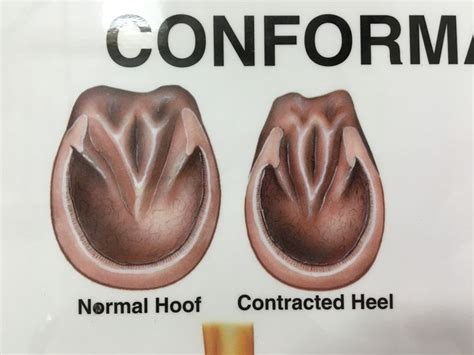 Normal Hoof Vs Contracted Heel Hooves Vet Med Heels