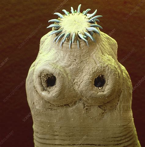 Colour Sem Of The Head Of A Tapeworm Taenia Sp Stock Image Z165