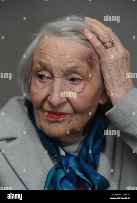 Lynne Elmer Laird 91 Shows A Bruise As She Speaks To Media Following The Sentencing Of Crack