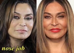 Tina Knowles Plastic Surgery Before And After Photos