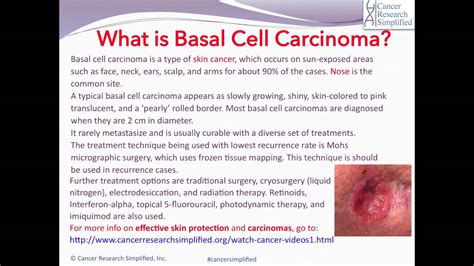 What Is Basal Cell Carcinoma By Cancer Education And Research
