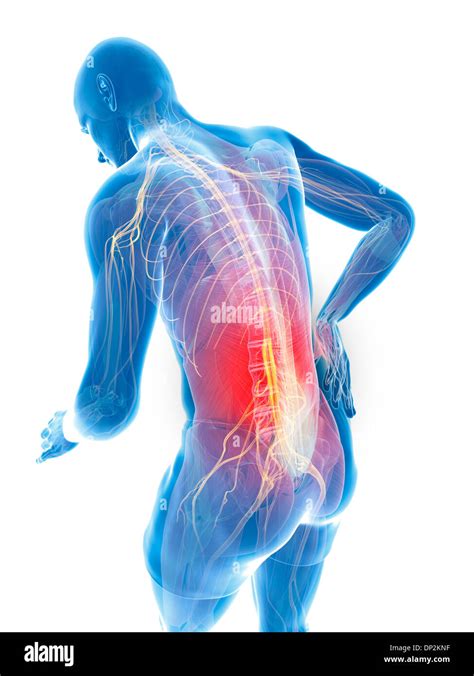 Back Pain Illustration Hi Res Stock Photography And Images Alamy