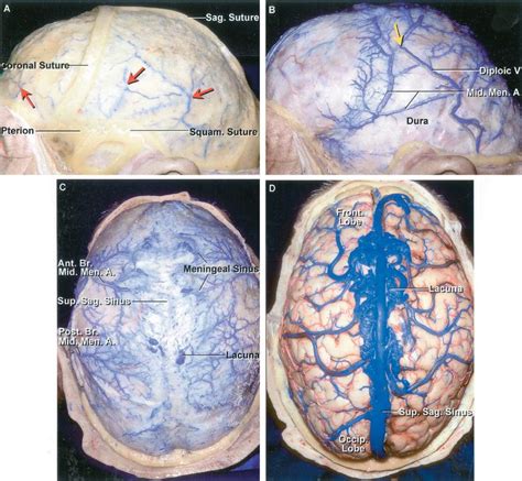 Diploic Veins Between Inner And Outer Table Neuroanatomy The