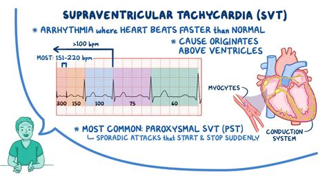 Svt Supraventricular Tachycardia Ventricular Paroxysmal Nursing Cardiac
