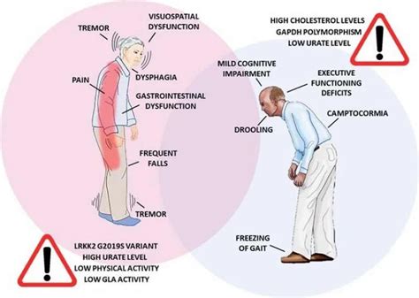 how and why does parkinson s disease affect women and men differently neuroscience news