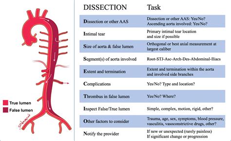 Aortic Dissection Radiology Reference Article Radiogy