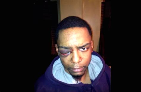 Gay Black Man Sues Brooklyn Shomrim And Nypd Over 2013 Beating The Forward