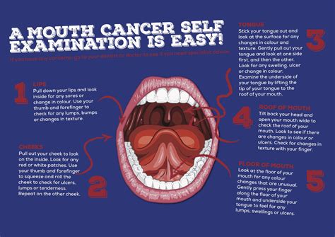 Action Month Lets Talk About Mouth Cancer