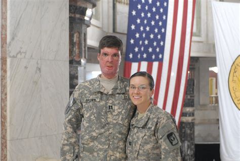Soldier S Life Altering Injury Turns Into Unique War Love Story Article The United States Army