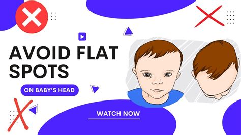 How To Prevent Flat Spots On Your Babys Head Plagiocephaly Youtube