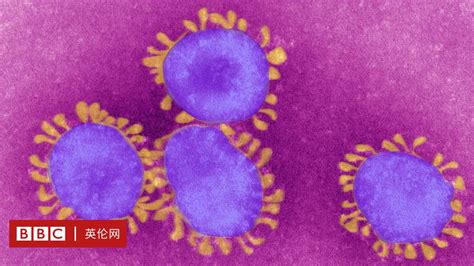 武漢新型冠狀病毒肺炎會成為全球流行病嗎？ Bbc 英伦网