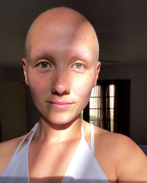 Women With No Eyebrows Explain Why Arches Arent Necessary Allure