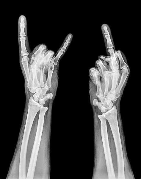 Obscene Gestures X Ray Photograph By Photostock Israel Fine Art America