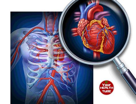 Cardiovascular Disease Symptoms And Types