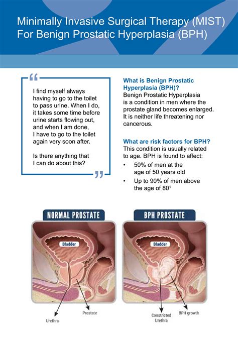 Minimally Invasive Surgical Therapy Mist For Benign Prostatic Hyperplasia Bph By Yishun