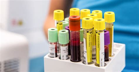10 Important Blood Tests What They Show Why Theyre Done More