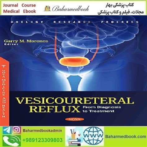 Vesicoureteral Reflux From Diagnosis To Treatment 2024 Tr