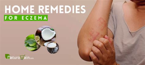 10 Natural Home Remedies For Eczema And Itching That Work