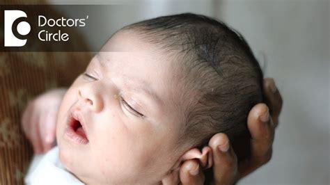 How To Ensure Right Shape Of Head In Newborns Dr Varsha Saxena