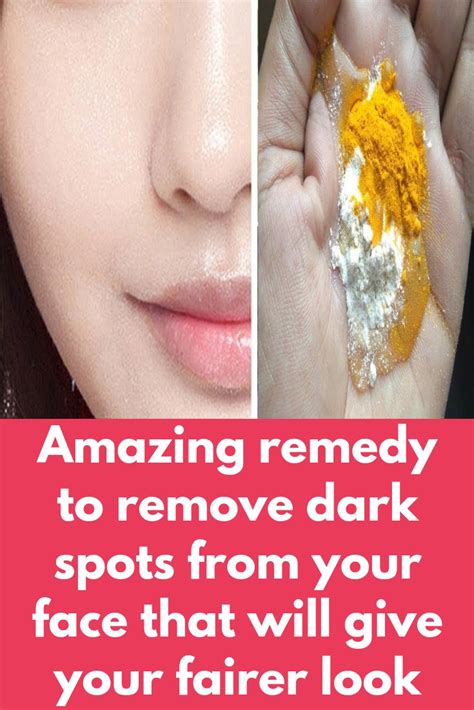 Amazing Remedy To Remove Dark Spots From Your Face That Will Give Your
