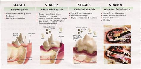 Stages Of Periodontal Disease Dog Dental Disease Periodontitis