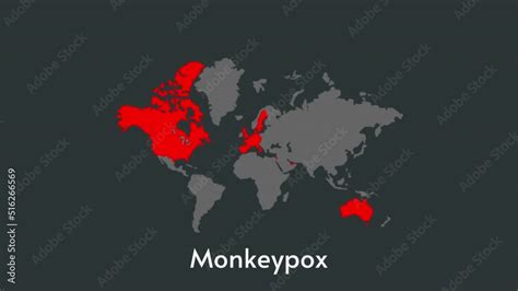 Virus 2022 Epidemic 2022 Map Of Monkeypox Stock 비디오 Adobe Stock