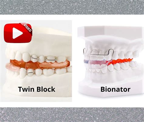 Twin Block Y Bionator Manejo En Dentición Mixta Odontovida