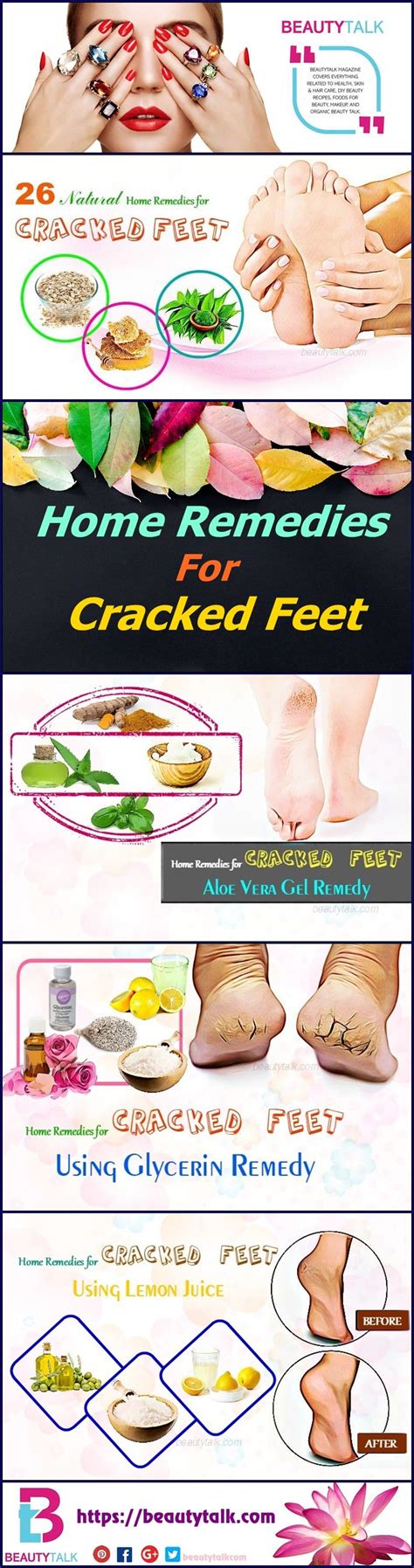 Start Your Autumn With 26 Natural Remedies For Cracked Feet Natural