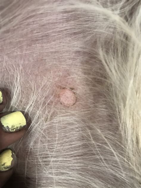 Peeling Skin On Inside Of Legs Golden Retriever Dog Forums