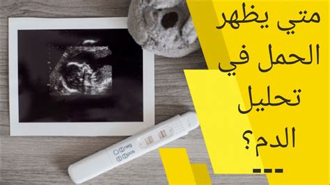 هل يظهر الحمل في تحليل الدم قبل موعد الدورة باسبوع هل يظهر الحمل في