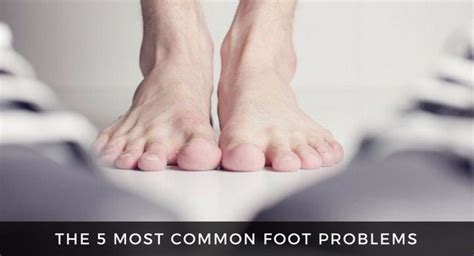 The 5 Most Common Foot Problems