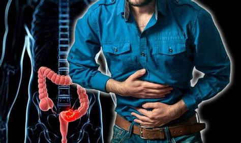Bowel Cancer Warning The Pain After Eating You Should Never Ignore