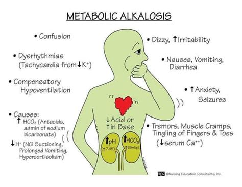 Alkalosis Nurse Metabolic Alkalosis Nursing Study