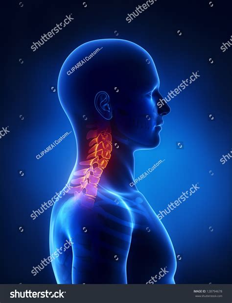 Cervical Spine Lateral View Stock Illustration 128794678 Shutterstock