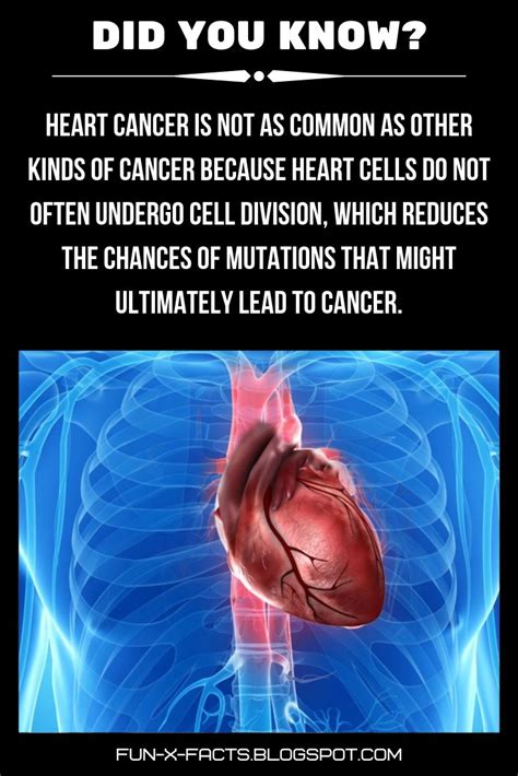 Heart Cancer Is Not As Common As Other Kinds Of Cancer Amazing Wtf Facts