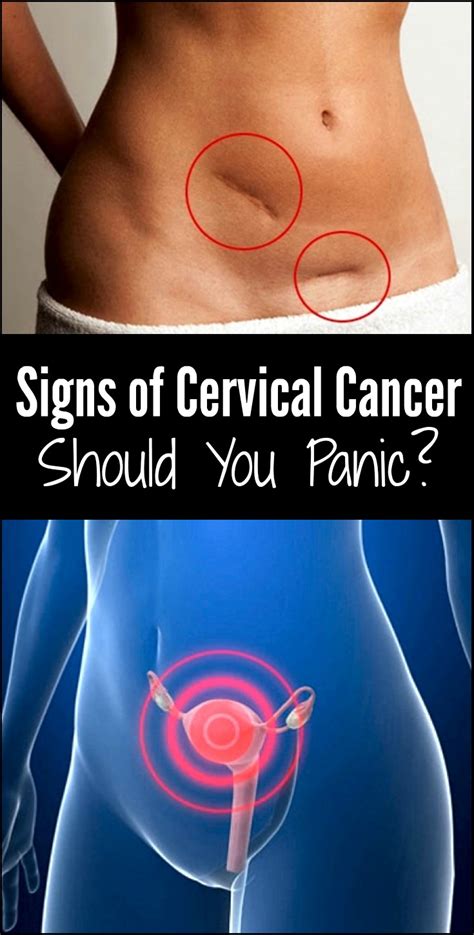 Menopause in the premenopausal women. Signs of Cervical Cancer: Should You Panic? - Ritely