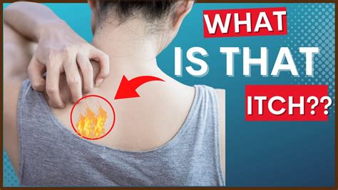 Notalgia Paresthetica “itchy Back” And Causes Symptoms And Tips For