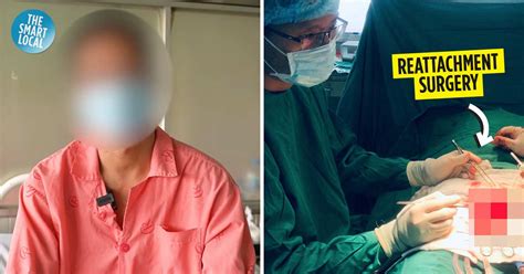 wife cut off husband s private parts doctors rushed to save his manhood