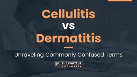Cellulitis Vs Dermatitis Unraveling Commonly Confused Terms